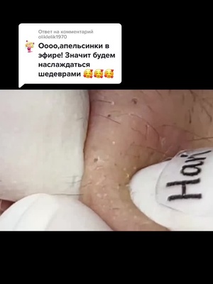 Ответ пользователю @liss..fxck